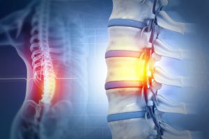 Human,Spinal,Cord,Injury,,Back,Pain,On,Blurred,Background.,3d